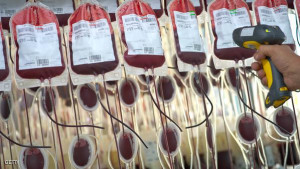 Bags with human complete blood are filtr